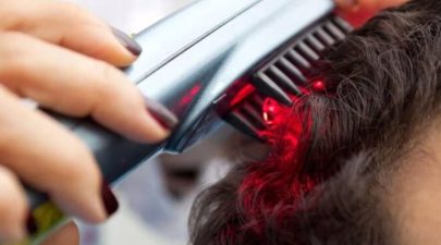 hair laser clinic