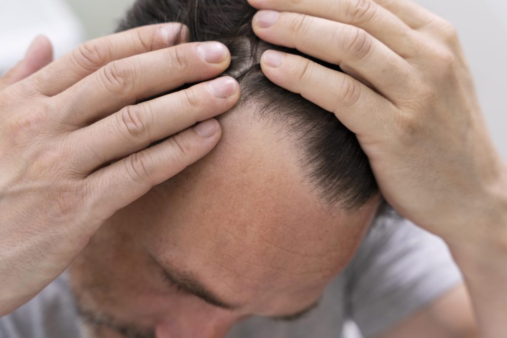 hair loss treatment for men