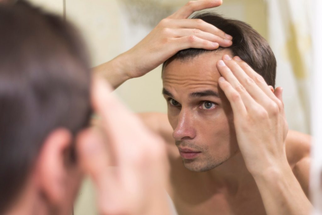hair loss treatment men