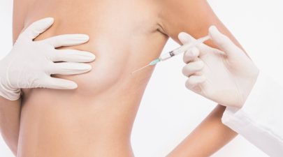 breast filler kl