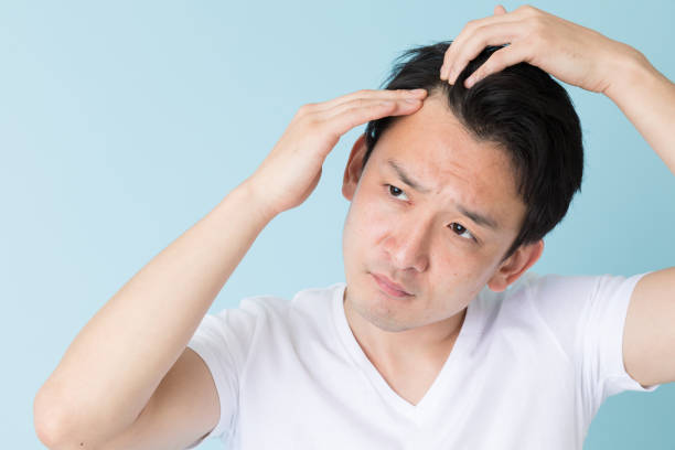 hair fall treatment