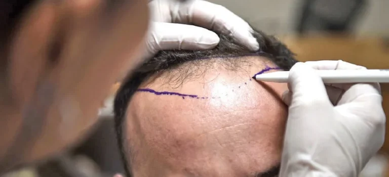 klinik rambut gugur