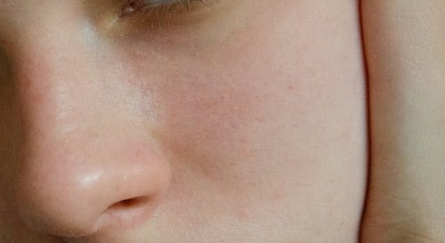 hydrating toner
