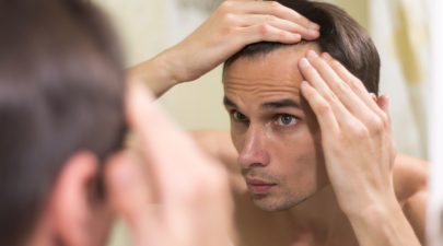 hair transplant malaysia
