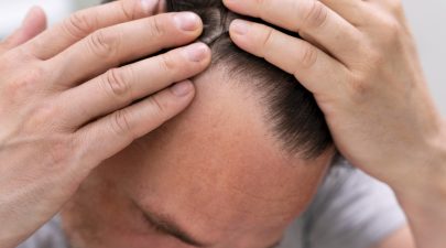 laser growth hair treatment