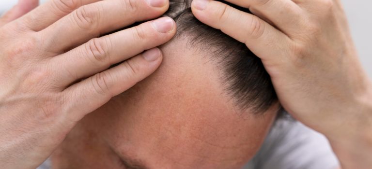 laser growth hair treatment