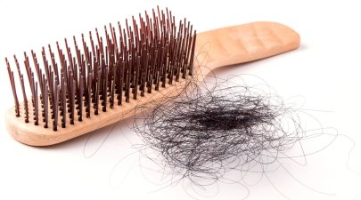 rambut gugur lelaki