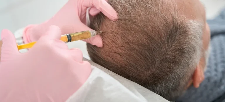 hair microneedling